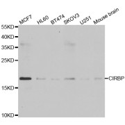 Western blot analysis of extracts of various cell lines, using CIRBP antibody (abx005033) at 1/1000 dilution.