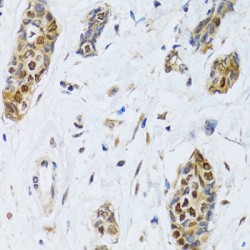 Cold-Inducible RNA-Binding Protein (CIRBP) Antibody