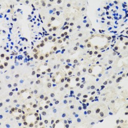 Cold-Inducible RNA-Binding Protein (CIRBP) Antibody