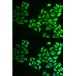 Cyclic AMP-Responsive Element Binding Protein 3 (CREB3) Antibody