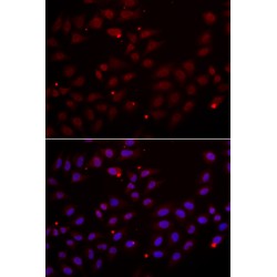 Cystatin-SA (CST2) Antibody