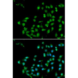 Beta-Catenin-Like Protein 1 (CTNNBL1) Antibody