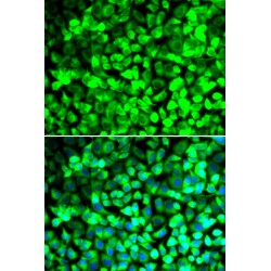 Eukaryotic Translation Initiation Factor 5 (EIF5) Antibody