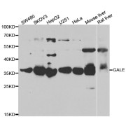 Western blot analysis of extracts of various cell lines, using GALE antibody (abx005057) at 1/1000 dilution.