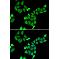 UDP-Glucose 4-Epimerase (GALE) Antibody