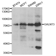 Western blot analysis of extracts of various cell lines, using GALNT3 antibody (abx005058) at 1/1000 dilution.