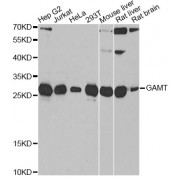 Western blot analysis of extracts of various cell lines, using GAMT antibody (abx005059) at 1/1000 dilution.