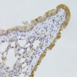 Glycerol-3-Phosphate Dehydrogenase 2 (GPD2) Antibody