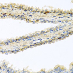 Glycosylphosphatidylinositol Specific Phospholipase D1 (GPLD1) Antibody