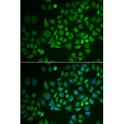 Glycosylphosphatidylinositol Specific Phospholipase D1 (GPLD1) Antibody