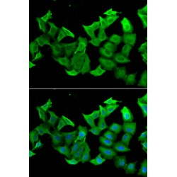 Hydroxyacylglutathione Hydrolase (HAGH) Antibody