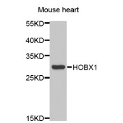 Western blot analysis of extracts of mouse heart, using HOXB1 antibody (abx005076) at 1/1000 dilution.