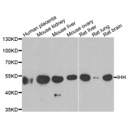 Western blot analysis of extracts of various cell lines, using IHH antibody (abx005080) at 1/1000 dilution.