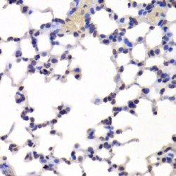 Integrator Complex Subunit 6 (INTS6) Antibody