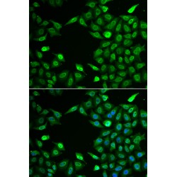 Integrator Complex Subunit 6 (INTS6) Antibody