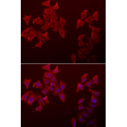 Leukocyte Cell Derived Chemotaxin 1 / LECT1 (CNMD) Antibody