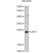 Western blot analysis of extracts of rat testis, using Lrat antibody (abx005095) at 1/1000 dilution.