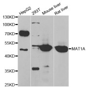 Western blot analysis of extracts of various cell lines, using MAT1A antibody (abx005097) at 1/1000 dilution.