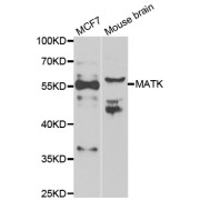 Western blot analysis of extracts of various cell lines, using MATK antibody (abx005098) at 1/1000 dilution.