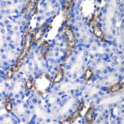 Megakaryocyte Associated Tyrosine Kinase (MATK) Antibody