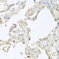 Multimerin 1 (MMRN1) Antibody