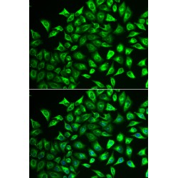 Multimerin 1 (MMRN1) Antibody