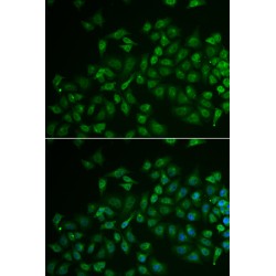 Membrane Protein, Palmitoylated 2 (MPP2) Antibody