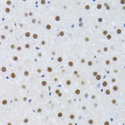 Metastasis-Associated Protein MTA3 (MTA3) Antibody