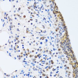 Metastasis-Associated Protein MTA3 (MTA3) Antibody