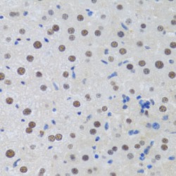 Metastasis-Associated Protein MTA3 (MTA3) Antibody