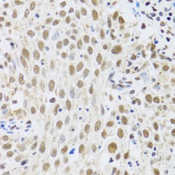 Metastasis-Associated Protein MTA3 (MTA3) Antibody