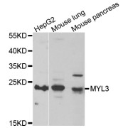 Western blot analysis of extracts of various cell lines, using MYL3 antibody (abx005108) at 1/1000 dilution.