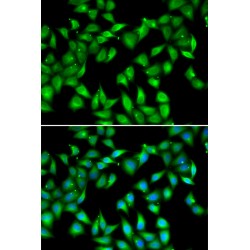 Myosin Light Chain 3 (MYL3) Antibody