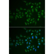 Immunofluorescence analysis of U2OS cells using MYLK3 antibody (abx005109). Blue: DAPI for nuclear staining.