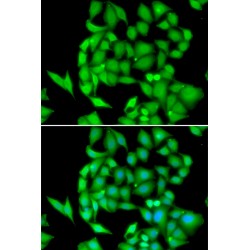 NIMA Related Kinase 3 (NEK3) Antibody