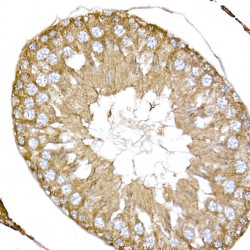 Nephrocystin 1 (NPHP1) Antibody