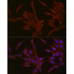 Nephrocystin 1 (NPHP1) Antibody