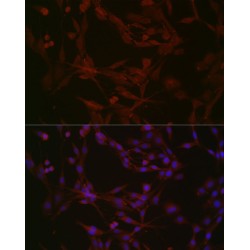 Nephrocystin 1 (NPHP1) Antibody