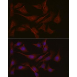 Nephrocystin 1 (NPHP1) Antibody