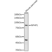 Western blot analysis of Mouse Pancreas Tissue, using NPHP1 antibody (1/1000 dilution).