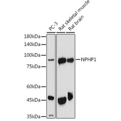 Nephrocystin 1 (NPHP1) Antibody