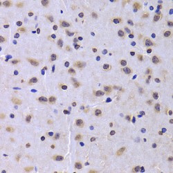 Nuclear Migration Protein NudC (NUDC) Antibody