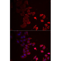 Purinergic Receptor P2X 4 (P2RX4) Antibody