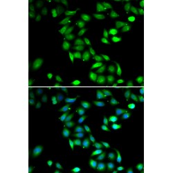 Programmed Cell Death Protein 6 (PDCD6) Antibody