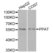 Western blot analysis of extracts of various cell lines, using PPAT antibody (abx005137) at 1/1000 dilution.