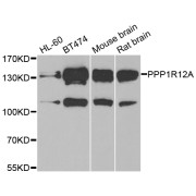 Western blot analysis of extracts of various cell lines, using PPP1R12A antibody (abx005139) at 1/1000 dilution.