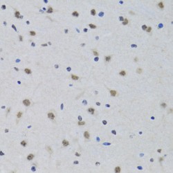 Pre-mRNA Processing Factor 19 (PRPF19) Antibody