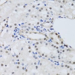 Pre-mRNA Processing Factor 19 (PRPF19) Antibody