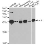 Western blot analysis of extracts of various cell lines, using RALB antibody (abx005151) at 1/1000 dilution.