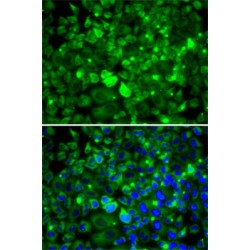 Ribosomal Protein Lateral Stalk Subunit P1 (RPLP1) Antibody